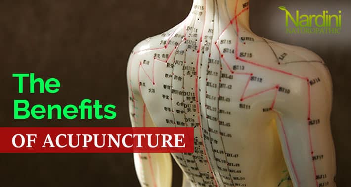 The Benefits Of Acupunture | Nardini Naturopathic