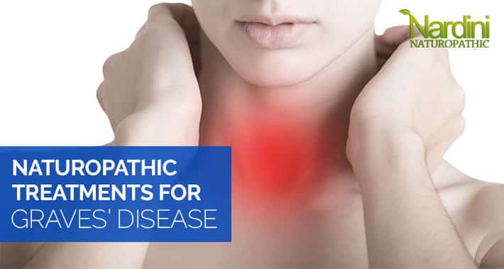 Naturopathic Treatments for Graves’ Disease | Nardini Naturopathic